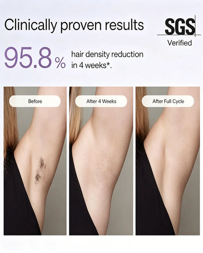 IPL Laser Hair Removal Device