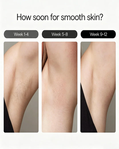 Sapphire Ice Cooling IPL Hair Removal Device